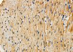 SLC8A1 Polyclonal Antibody