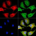 SLC28A1 Polyclonal Antibody