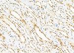 SFRS18 Antibody in Immunohistochemistry (Paraffin) (IHC (P))