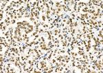 SFRS18 Antibody in Immunohistochemistry (Paraffin) (IHC (P))