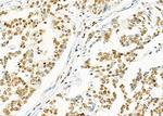SFRS18 Antibody in Immunohistochemistry (Paraffin) (IHC (P))