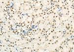 SFRS18 Antibody in Immunohistochemistry (Paraffin) (IHC (P))