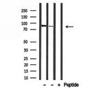SFRS18 Antibody in Western Blot (WB)