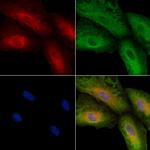 SV2C Polyclonal Antibody