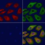 TBC1D2 Polyclonal Antibody