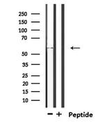 TIGD4 Polyclonal Antibody
