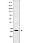 TM2D1 Polyclonal Antibody