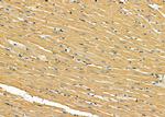 TRAK2 Antibody in Immunohistochemistry (Paraffin) (IHC (P))