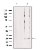 TRAPPC5 Polyclonal Antibody
