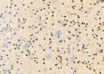TCEAL2 Polyclonal Antibody