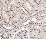 TCEAL8 Polyclonal Antibody