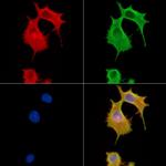 BTF3L4 Polyclonal Antibody