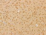 BTF3L4 Antibody in Immunohistochemistry (Paraffin) (IHC (P))