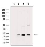 BTF3L4 Antibody in Western Blot (WB)