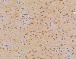 LSM2 Polyclonal Antibody