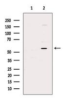 USP14 Polyclonal Antibody
