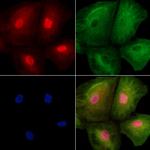 USP17L1 Polyclonal Antibody