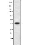 USP3 Antibody in Western Blot (WB)