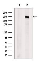 UBE4B Antibody in Western Blot (WB)
