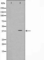 CD226 Polyclonal Antibody