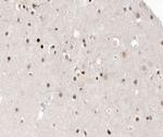 HDAC9 Polyclonal Antibody