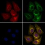 MEKK6 Polyclonal Antibody