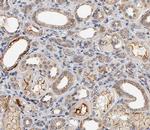 MEKK6 Antibody in Immunohistochemistry (Paraffin) (IHC (P))