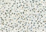 MEKK6 Antibody in Immunohistochemistry (Paraffin) (IHC (P))