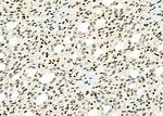 MEKK6 Antibody in Immunohistochemistry (Paraffin) (IHC (P))