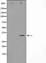 ZRANB2 Polyclonal Antibody