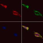 HDAC7 Polyclonal Antibody