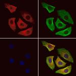 CDC25B Polyclonal Antibody