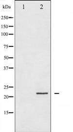 CPI-17 alpha Polyclonal Antibody