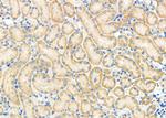 CD164L2 Antibody in Immunohistochemistry (Paraffin) (IHC (P))