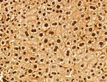 ADRM1 Antibody in Immunohistochemistry (Paraffin) (IHC (P))