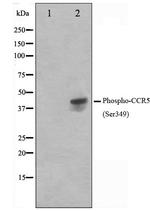 Phospho-CCR5 (Ser349) Antibody in Western Blot (WB)