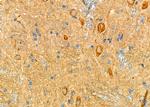 ANP32C Antibody in Immunohistochemistry (Paraffin) (IHC (P))