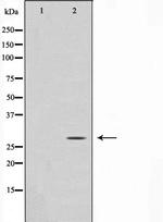 ANP32C Antibody in Western Blot (WB)
