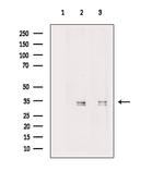 MBD3 Polyclonal Antibody