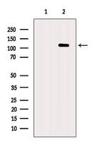 XRN2 Antibody in Western Blot (WB)