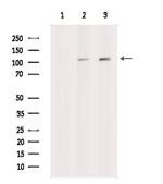 XRN2 Antibody in Western Blot (WB)