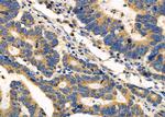 ADCK1 Polyclonal Antibody