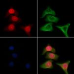 GTF2H2 Polyclonal Antibody