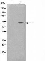 GTF2H2 Antibody in Western Blot (WB)