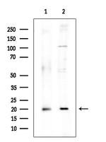 CDKN2C Antibody in Western Blot (WB)