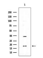CDKN2C Antibody in Western Blot (WB)