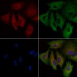 GPRIN1 Antibody in Immunocytochemistry (ICC/IF)