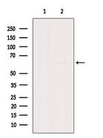 GK2 Polyclonal Antibody