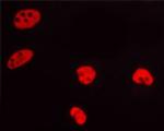 Phospho-Progesterone Receptor (Ser400) Antibody in Immunocytochemistry (ICC/IF)