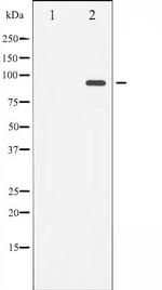 Phospho-Progesterone Receptor (Ser400) Antibody in Western Blot (WB)